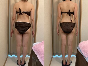 ハッテンビューティーパーク 神戸店(Hatten Beauty Park 810)/モニター様ビフォーアフター