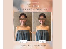 レジオス 名古屋丸の内店(Regios)の雰囲気（フェイスライン～デコルテの変化で痩せた？と言われる変化を☆）