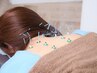 【人気No1】鍼で体の緊張を緩めて正すオーダーメイド鍼灸マッサージ整体60分