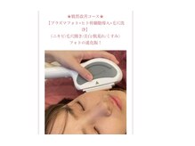 エステティックサロン さらの雰囲気（肌荒れ/赤ら顔/毛穴/ニキビケアには肌質改善プラズマフォトが◎）