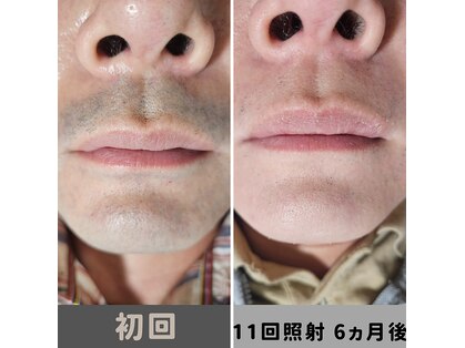 キムラケ 和光別邸(木村家 KIMURAKE)の写真