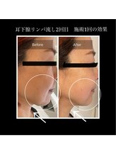 マシュマロヘッド 目黒店(Mashumaro Head)/本格顔深層筋小顔フェイシャル 