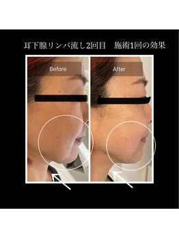 マシュマロヘッド 目黒店(Mashumaro Head)/本格顔深層筋小顔フェイシャル 