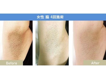 シャイン(SHINE)/