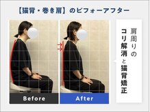 肩甲骨はがしで可動域を広げ、肩こり＆猫背改善◎【整体/腰痛】