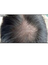 キュライム カブール町田店/頭頂部のボリュームダウンにも