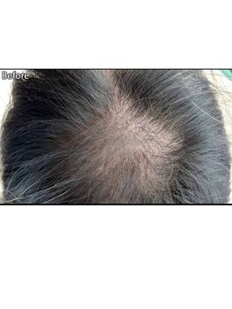 キュライム カブール町田店/頭頂部のボリュームダウンにも