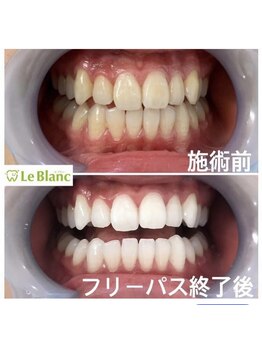 ルブラン 奈良店(Le Blanc)/コーヒーが好きな方へ