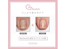 メグ(Meg)の雰囲気（巻き爪でお悩みの方お気軽にご相談ください）