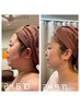 【500円OFF】☆男女☆スライドカッピング顔20分 ￥9,900→￥9400