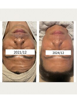 インチャント(enchant)/男性も綺麗にします!