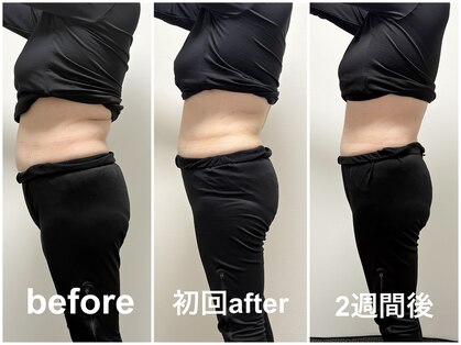 ヨサパーク プラム(YOSA PARK Plum)の写真