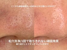 ピブ(pib.)/１回で取り切ることが大前提！！