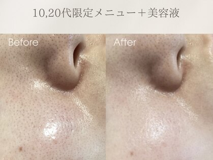 リアン(Rien)の写真