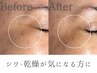 シワケア人気No.1【目元・口元のシワに】ゾンビマスク+美容液導入(120分)
