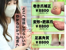 爪のいろは