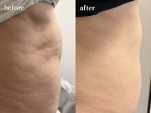 ヘルディン(heldin +555)の雰囲気(ダイエットで落ちない脂肪を徹底燃焼!効果は半永久!脂肪分解♪)