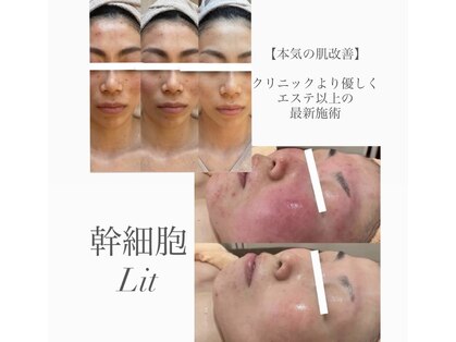 テラ(terra.)の写真