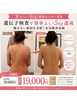 ケイビューティ(k-beauty)の写真/15年ベテラン在籍/リピート率90%越え♪-10キロ成功者続出☆インディバ/痩身/東新宿/k-beauty