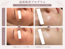 メゾンリュバン 梅田店(Maison Ruban)の雰囲気（透明感爆誕◎最新肌育プログラム）