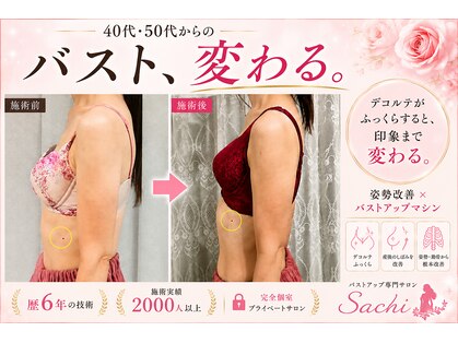サチ(Sachi)の写真