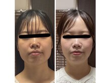 ボーンズ(BONES)の雰囲気（優しく、痛みの少ない小顔矯正です）