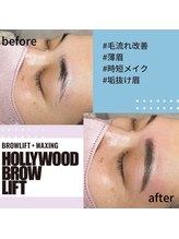 サロンドオズ(Salon de OZ)/ハリウッドブロウリフト