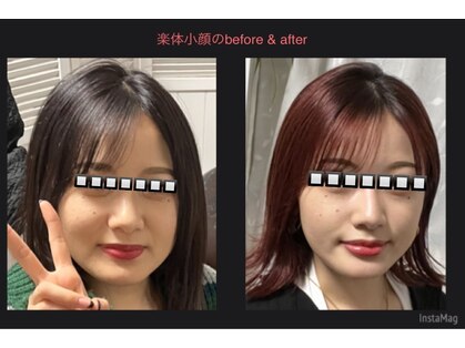 地下鉄なんば駅の小顔矯正 造顔がおすすめのサロン 口コミ人気ランキング ホットペッパービューティー