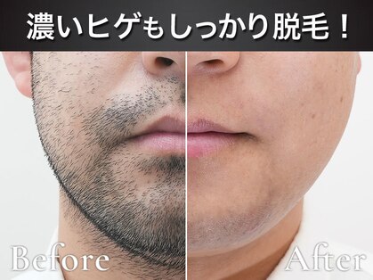 レイロール 錦糸町店(RAYROLE)の写真