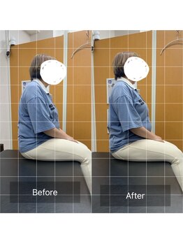 ナオル整体 武蔵小杉院(NAORU整体)/20代女性　猫背・肩こり