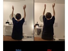 美バディ(美buddy)/諦めていた腕の上がりも