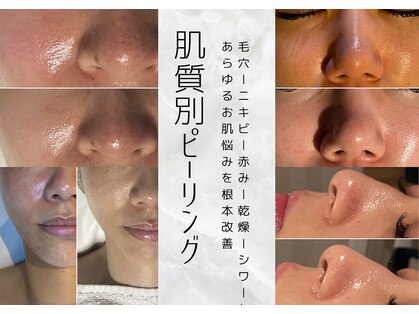 レアリゼ(Realiser)の写真