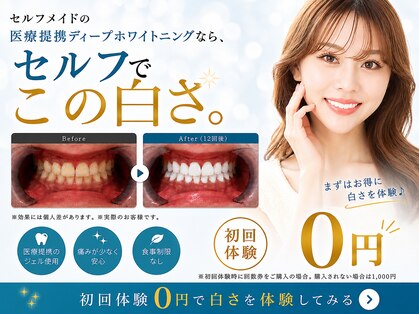 セルフメイド 宇部本店(SELFMADE)の写真