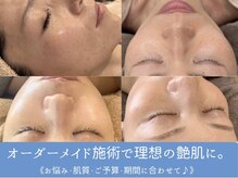 シュリー(Sriii)の雰囲気(エンビロン・セルマン・ハーブピーリング・インディバで艶肌に♪)