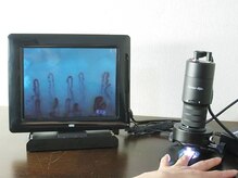 プシュケ(PSYCHE)/血管美人チェック