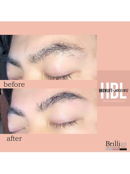 ブリリアン/メンズ ハリウッドブロウリフト