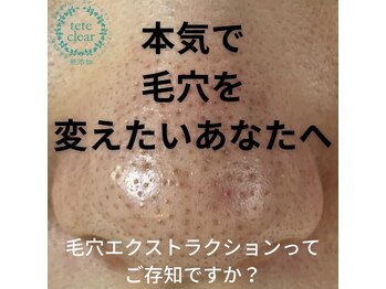 アイシェリー(eyecherie)/毛穴エクストラクション