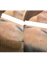 デューン 蕨店(Dune)/before/after20代後半女性