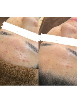 デューン 蕨店(Dune)/before/after20代後半女性