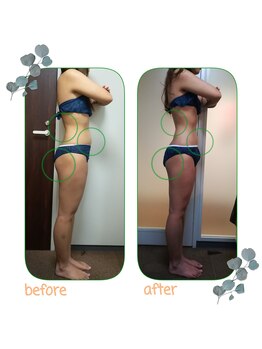 ダイエット サポート(DIET SUPPORT)/3ヶ月コース 施術結果
