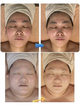 プルフローラ(pluflora)/お悩みに合わせたフェイシャル2