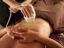 アヴィジョン(Avision)/