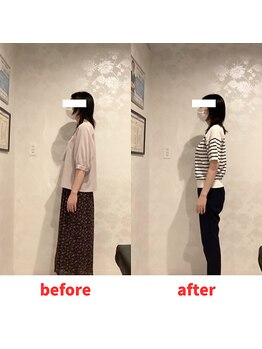 ナオル整体 福岡香椎院(NAORU整体)/30代女性施術事例【姿勢改善】