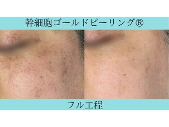 リメイククリニカルビューティー(Remake clinical beauty)/いつの間にか現れた