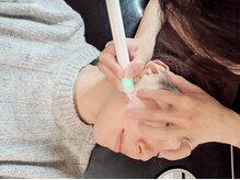 痛みが少ないシミケア◎