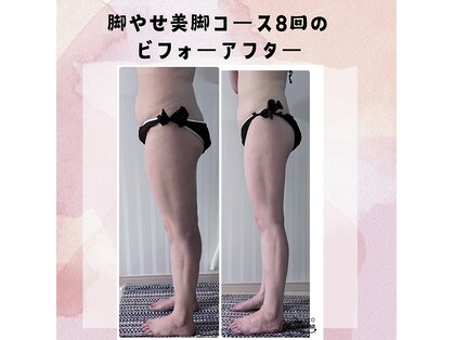 アイナ(aina)の写真