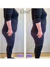 リセット(Reset)/骨盤底筋にもアプローチします