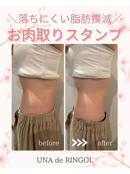 ウナ デ リンゴル 恵比寿店(UNA de Ringol)/ボディ痩身¥18,000