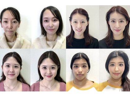 ブリリオディーバ(Brillio Diva)の写真