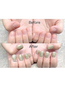 爪の悩みを解消できる（ケア含む）